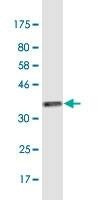 Anti-KIR3DX1 Antibody