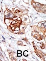 Anti-TTK (MPS1) (N-term) Antibody