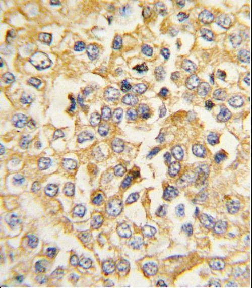 Anti-Natriuretic Peptide Receptor A (N-term) Antibody
