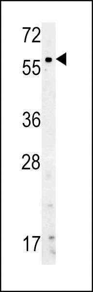 Anti-Natriuretic Peptide Receptor C (N-term) Antibody
