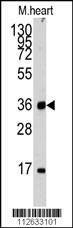 Anti-ULK3 (N-term) Antibody