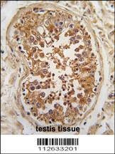 Anti-ULK3 (N-term) Antibody