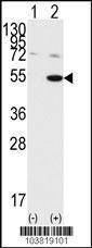 Anti-GSK3 alpha (GSK3A) (C-term) Antibody
