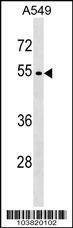 Anti-GSK3 alpha (GSK3A) (C-term) Antibody