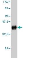 Anti-KIT Antibody