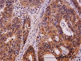 Anti-KIT Antibody