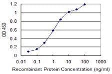 Anti-KIT Antibody