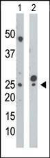Anti-UCK (N-term) Antibody