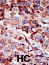Anti-AK2 (C-term) Antibody