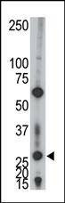 Anti-AK2 (C-term) Antibody