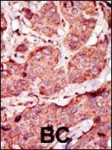 Anti-PFKP (C-term) Antibody