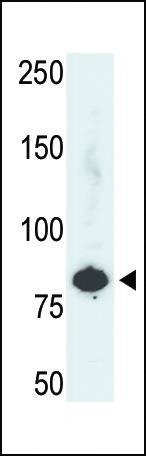 Anti-PFKL (C-term L684) Antibody