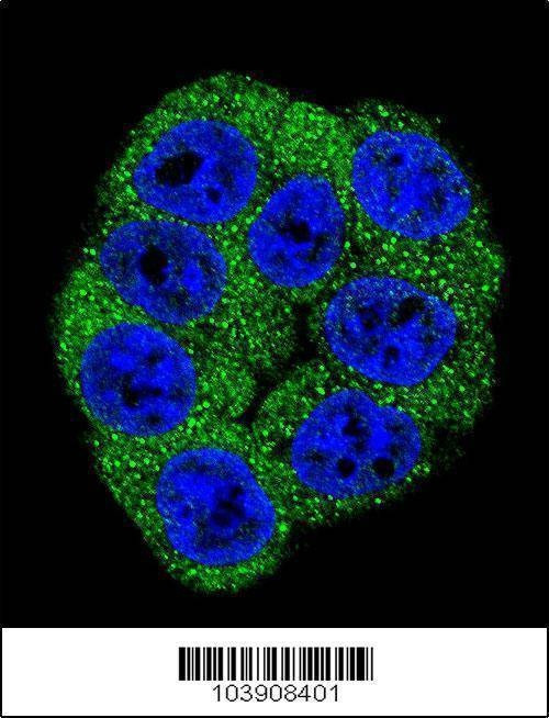Anti-Fructose 6 Phosphate Kinase (PFKM) (C-term) Antibody