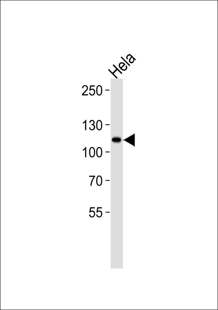 Anti-HK2 (Hexokinase II) (N-term) Antibody