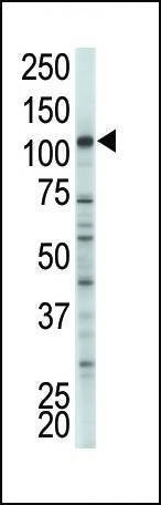 Anti-HK2 (Hexokinase II) (Center) Antibody