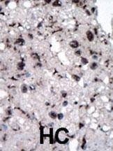 Anti-HK2 (Hexokinase II) (Center) Antibody