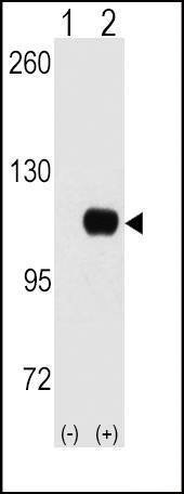 Anti-HK1 (C-term) Antibody