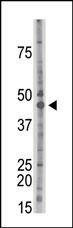 Anti-CKII alpha (CSNK2A1) (Center) Antibody