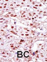 Anti-CKII alpha (CSNK2A1) (Center) Antibody