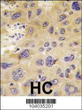 Anti-PFKFB1 (N-term) Antibody