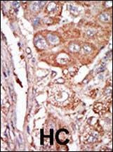 Anti-FGF4 (C-term) Antibody