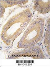 Anti-FGF4 (C-term) Antibody