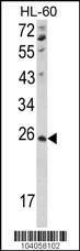 Anti-NME4 (C-term) Antibody
