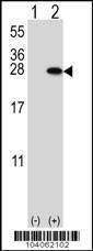 Anti-YWHAB (N-term) Antibody