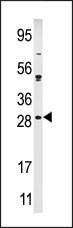 Anti-KIP2 (N-term) Antibody