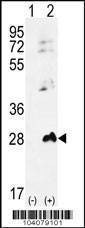 Anti-AK1 (N-term) Antibody