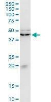 Anti-KLF13 Antibody
