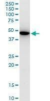 Anti-KLF13 Antibody