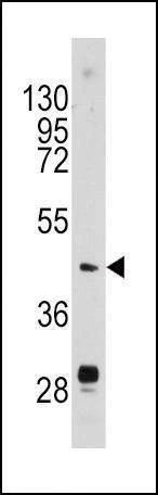 Anti-Urokinase (PLAU) (N-term) Antibody