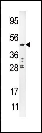 Anti-Urokinase (PLAU) (C-term) Antibody