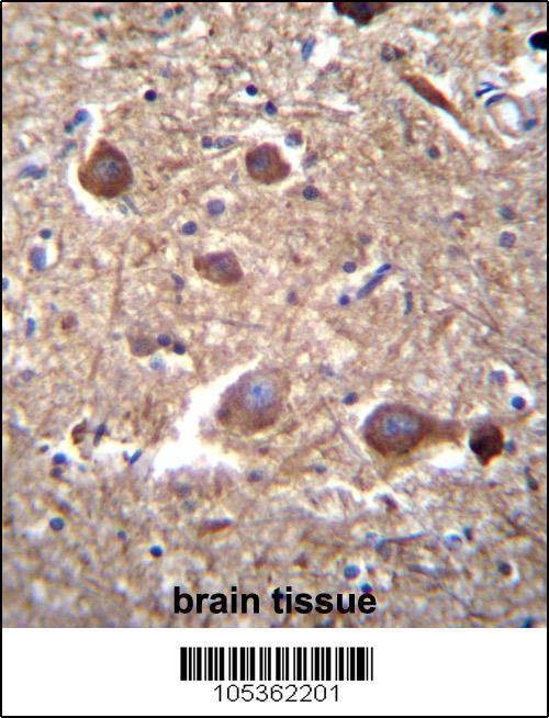 Anti-ITPKB (N-term) Antibody