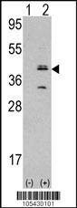 Anti-MVP (N-term) Antibody
