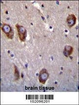 Anti-BAI1 (C-term) Antibody
