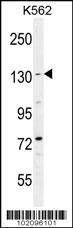 Anti-BAI1 (C-term) Antibody