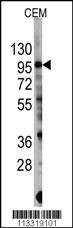 Anti-PIK3CG (S1100) Antibody