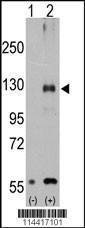 Anti-TRPM8 (Center R536) Antibody