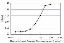 Anti-KLF5 Antibody
