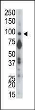 Anti-PTP alpha (N-term) Antibody