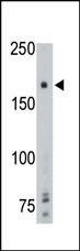 Anti-PTP gamma (Center) Antibody