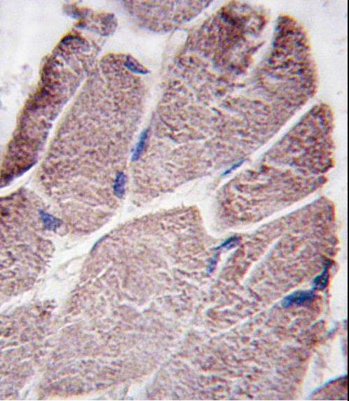 Anti-PTPD1 (Center) Antibody