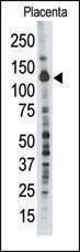 Anti-PTPD1 (Center) Antibody