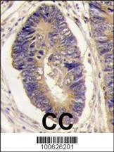 Anti-PTPH1 (Center) Antibody