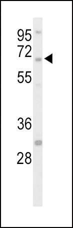 Anti-STEP / PTPN5 (N-term) Antibody