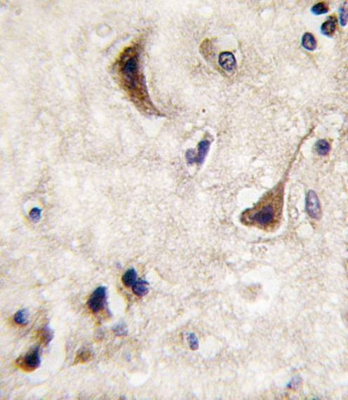 Anti-STEP / PTPN5 (N-term) Antibody