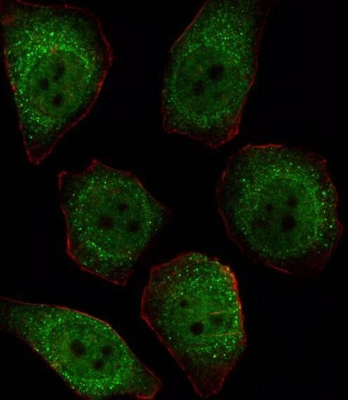 Anti-Protein Phosphatase 1 beta (PPP1CB) (C-term) Antibody