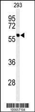 Anti-PPM1G (Center) Antibody